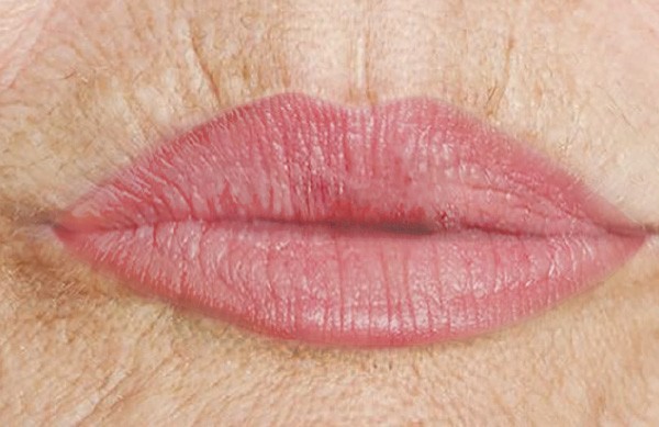 bestage-lippen